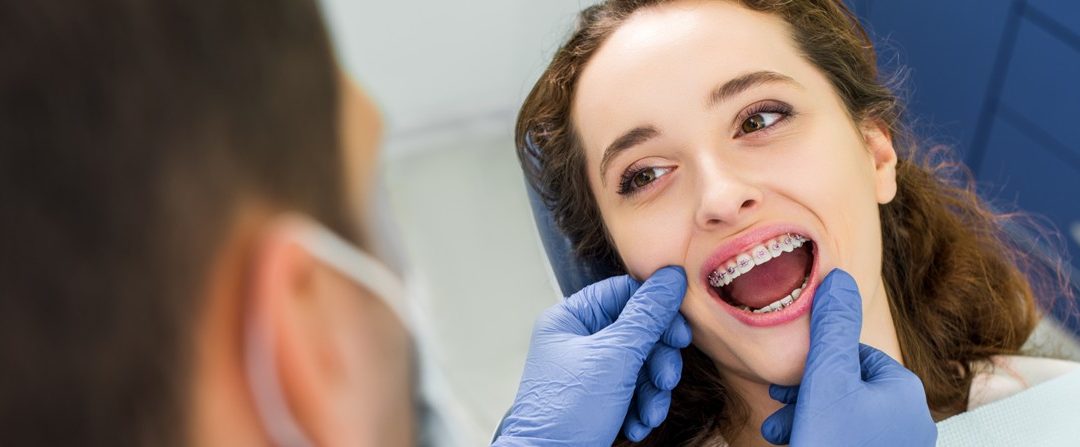 ¿Manchas blancas en los dientes? Sus causas y solución